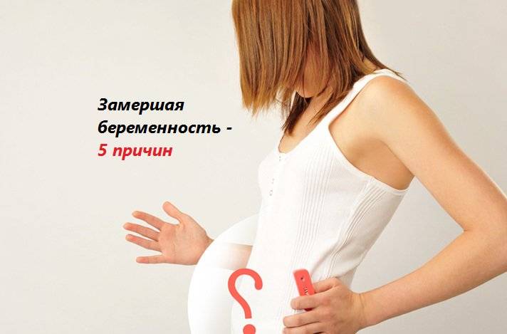 Самопроизвольное прерывание беременности: причины, симптомы, диагностика и лечение