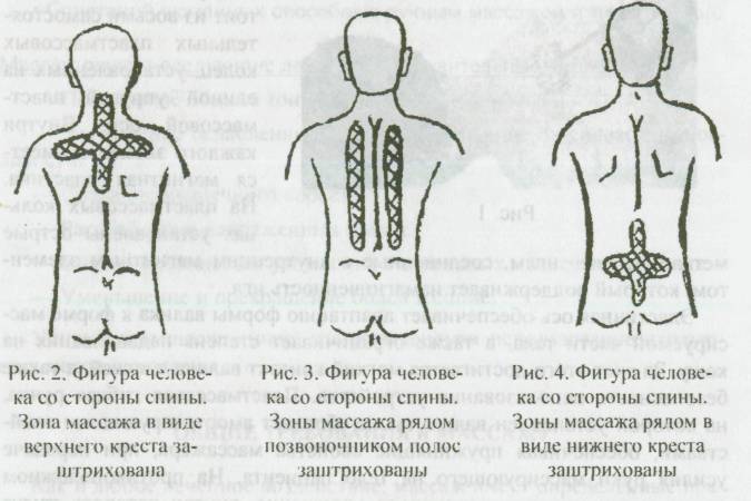 Массаж при сколиозе картинки