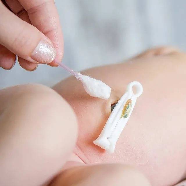 Хлорофиллипт для обработки пупка новорожденных: инструкция по применению и отзывы