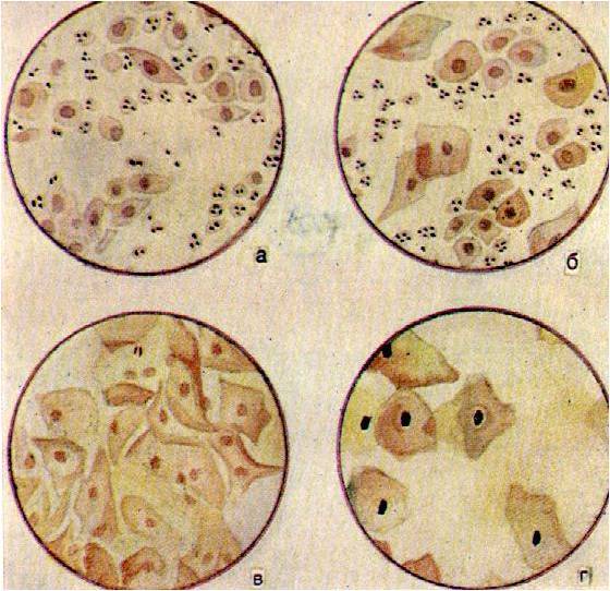 Йодофильные бактерии в кале у ребенка: о чем говорит копрограмма