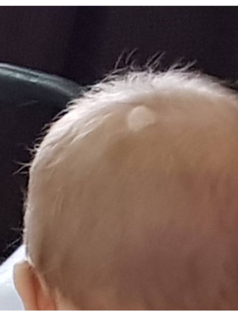 Почему у новорожденного ребенка плохо растут волосы?