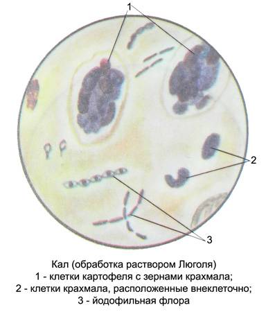 Крахмал в кале. Микроскопия кала крахмал. Крахмал в Кале микроскопия. Микроскопия кала йодофильная Флора. Копрология кала микроскопия.