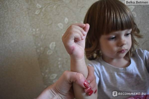 Если ребенок (или взрослый) сосет пальцы, грызет ногти