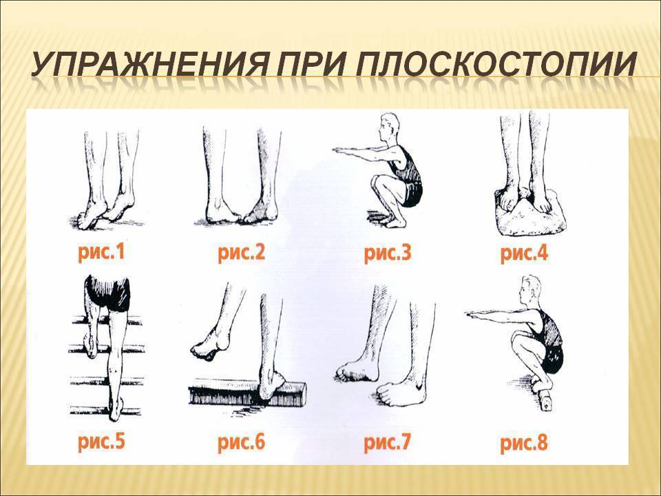 Упражнения при плоскостопии у детей — комплекс тренировок дома с видео — med-anketa.ru