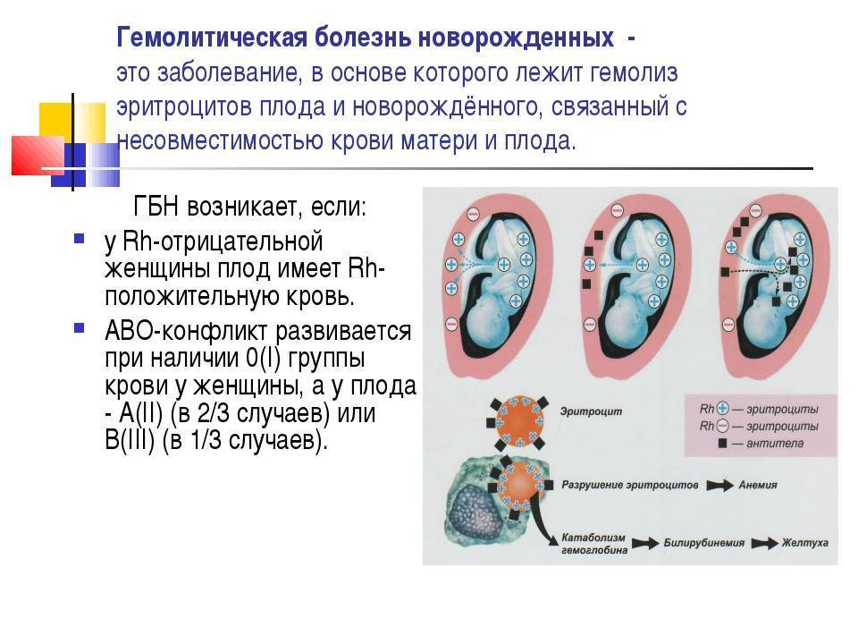 Как лечить блефарит у грудничков?