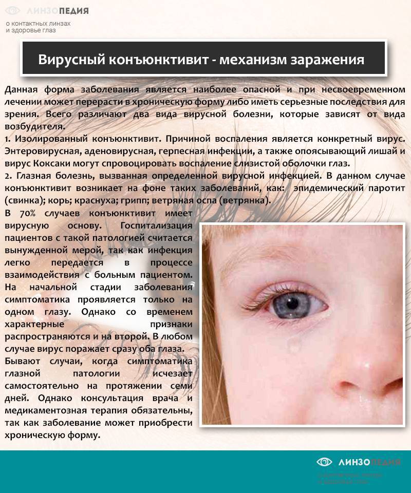Бактериальный конъюнктивит: лечение у детей, симптомы, как отличить от вирусного заболевания глаз