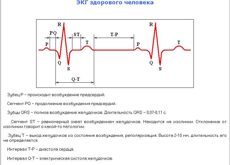 Велоэргометрия (вэм). проведение сердечного диагностического теста.