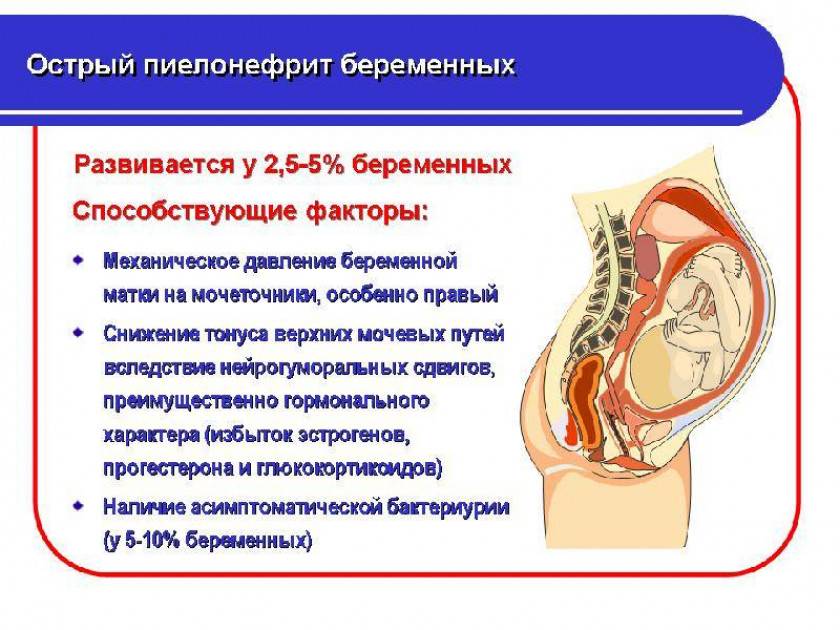 Боли в горле при беременности | москва