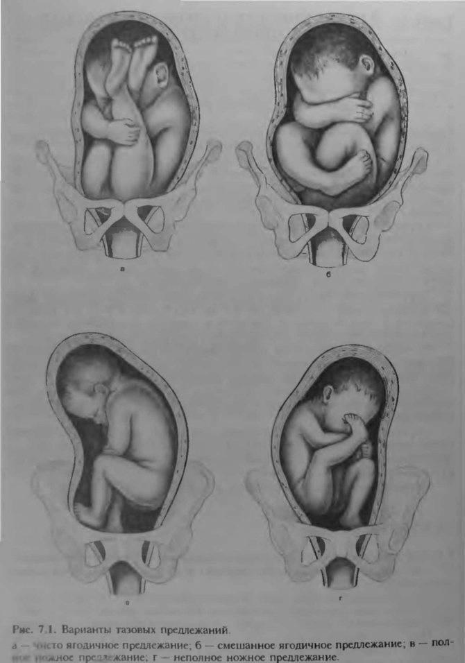 Расположение ребенка в животе по неделям беременности фото
