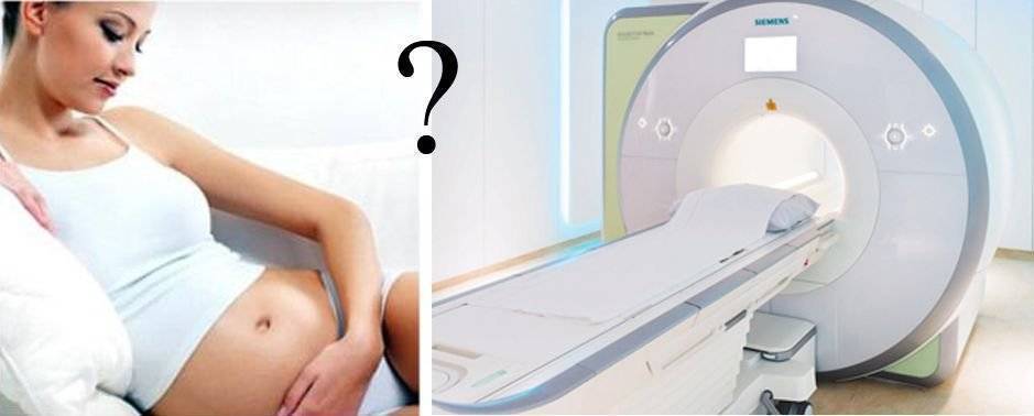 Часто задаваемые вопросы — отделение рентгеновской компьютерной томографии