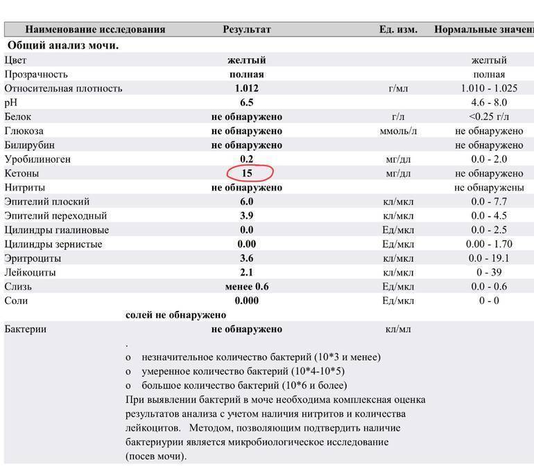 Обследование почек. анализы. кровь, слизь, песок, камни в моче.