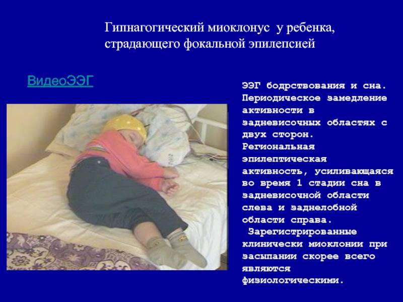 Почему сводит икры ног | причины судорог, профилактика и методы лечения
