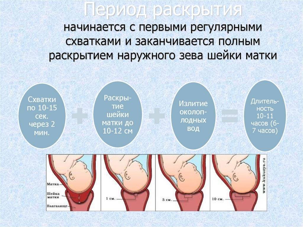 Роды после снятия пессария: применение пессария, процедура снятия, сроки родов и рекомендации гинекологов