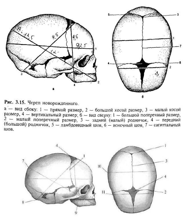 Череп новорожденного ребенка