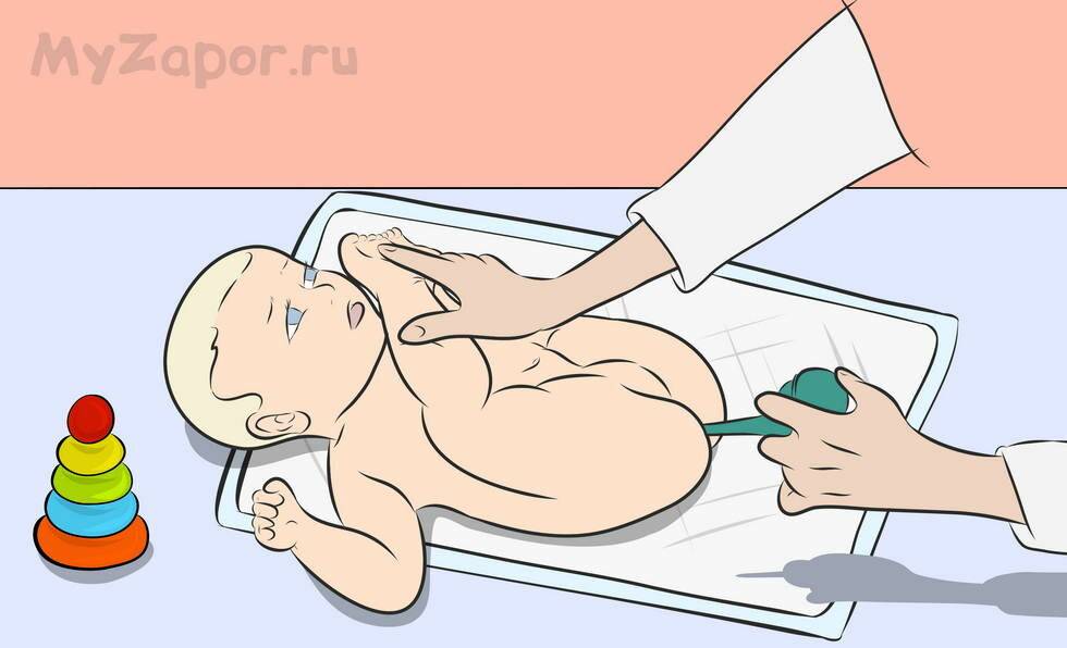 Клизма для новорожденных при запорах