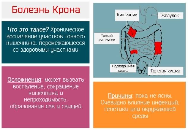 Болезнь крона. симптомы, диагностика и лечение болезни крона.!