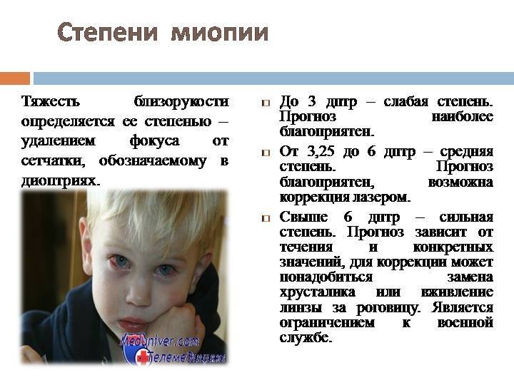 Близорукость у ребенка 11-12 лет и детская миопия. диагностика,  лечение в москве | клиника «новый взгляд»