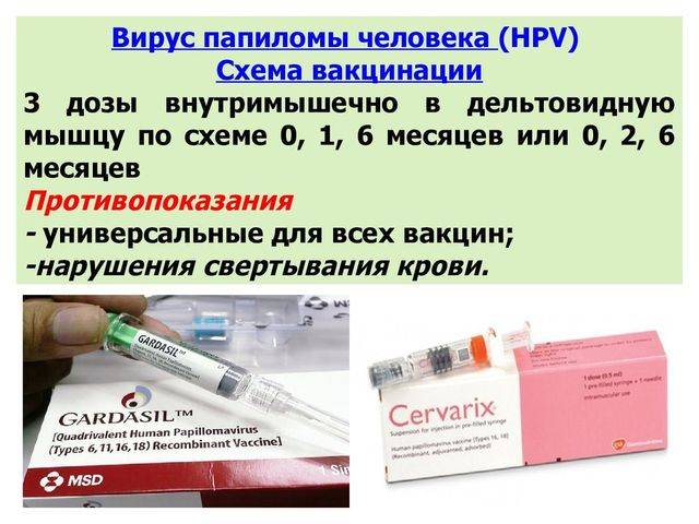Прививка от впч: вакцины гардасил и церварикс — цены в москве | клиника семейный доктор