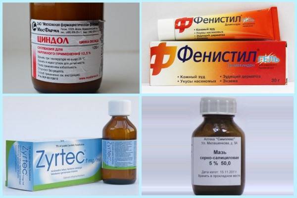 Лобный синусит (фронтит): что это и как лечить?