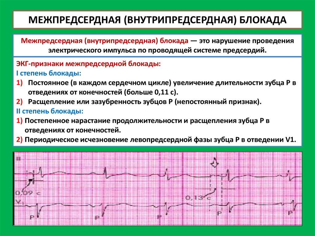 Заболевания, сопровождающиеся нарушением сердечного ритма и проводимости: причины, симптомы, диагностика и методы лечения на сайте «альфа-центр здоровья»