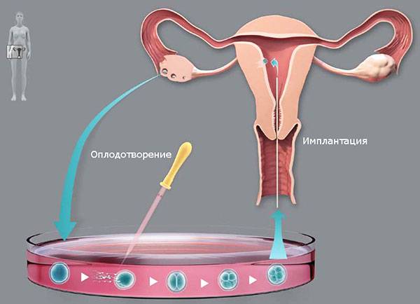 Перенос эмбриона: какой день наиболее благоприятный для проведения процедуры