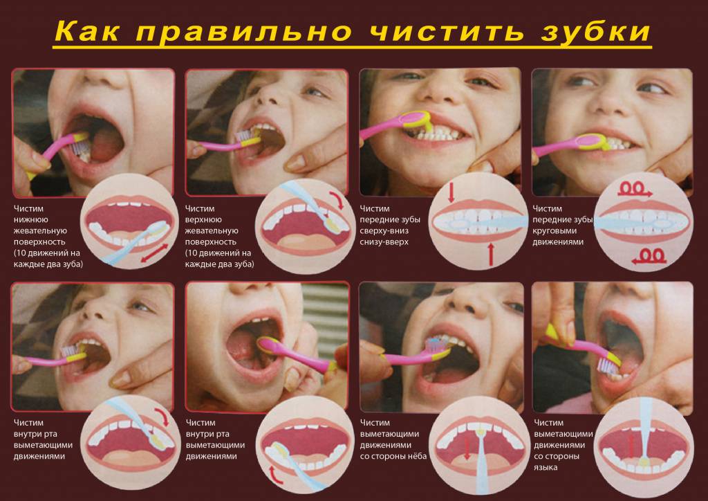 Когда начинать чистить зубы малышу: как чистить и ухаживать за молочными зубами
