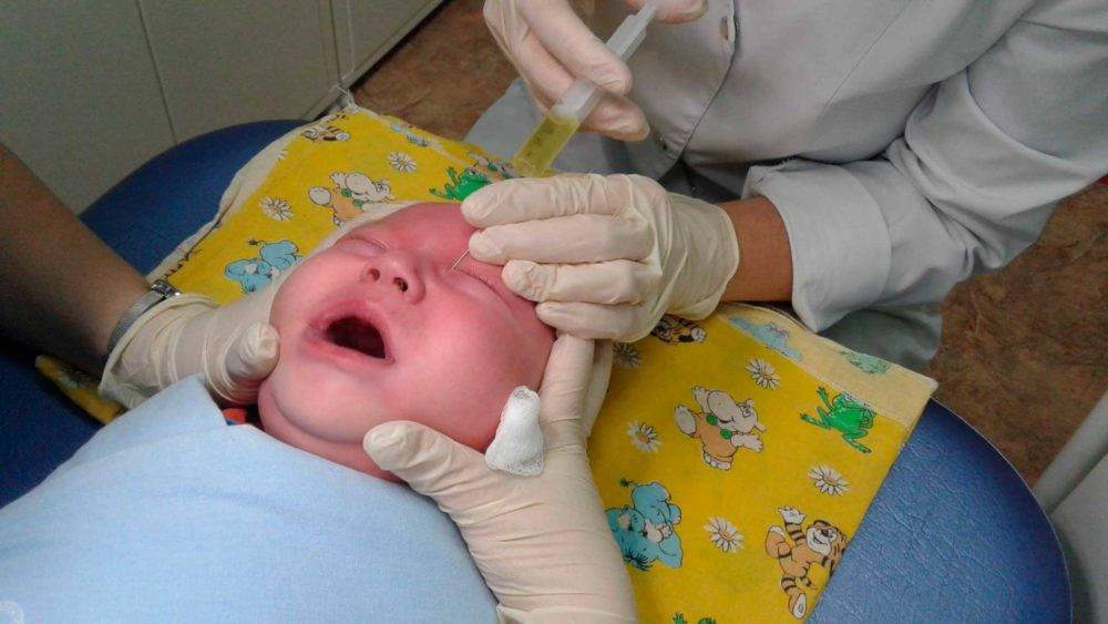 Доктор комаровский о массаже слезного канала у новорожденных