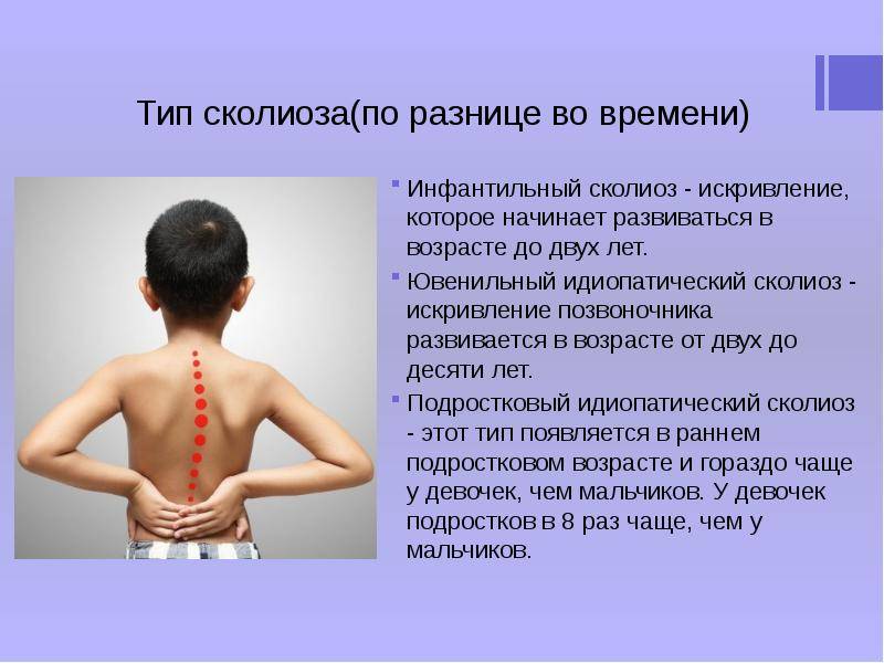 Лечение сколиоза без операций и в любом возрасте