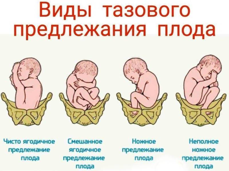 Как понять что головка ребенка опустилась в таз и когда рожать