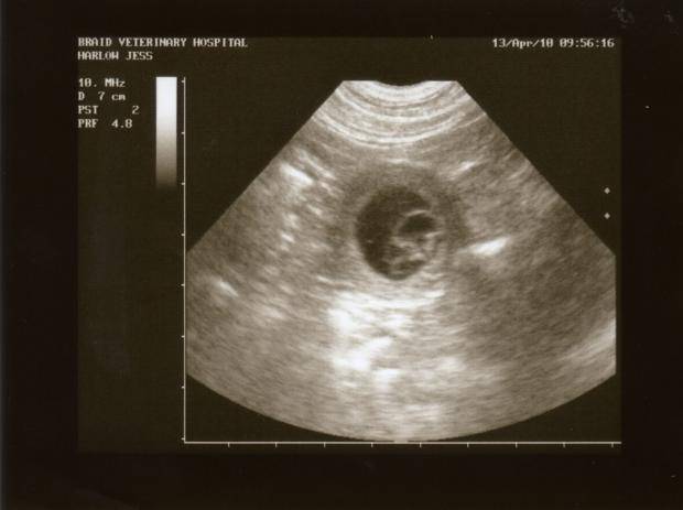3 неделя беременности: что происходит в 1 месяц от зачатия?