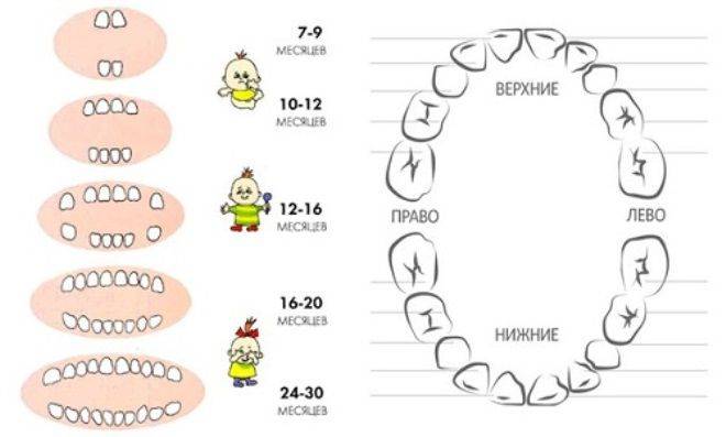 Последовательность прорезывания зубов у детей: симптомы и схема