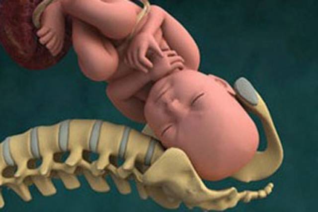 Искусственные роды: показания к процедуре и прогнозы для беременной