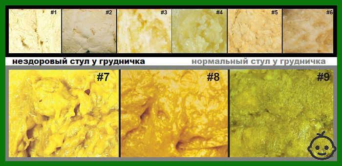 Что делать, если у ребенка возник запор после введения прикорма