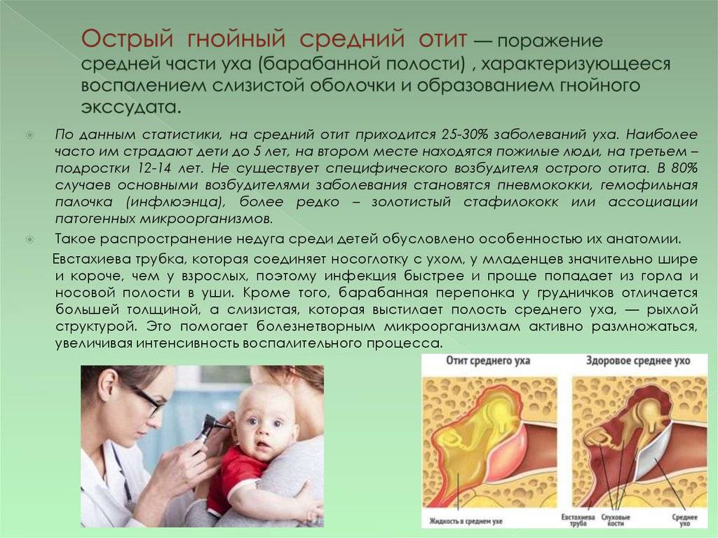 Гнойный отит у ребенка - лечение и симптомы разных форм заболевания уха