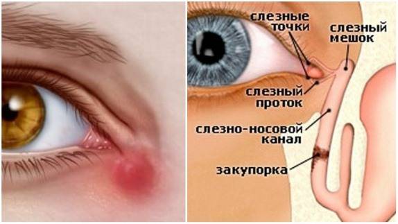 Исправление косоглазия у детей до года - энциклопедия ochkov.net
