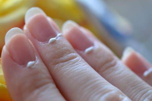 Проблема с ногтями у ребёнка — 11 ответов врачей на вопрос на сайте спросиврача