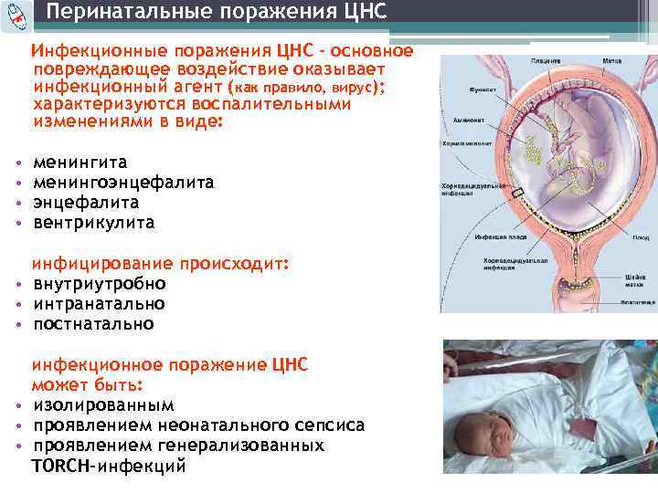 Перинатальное поражение центральной нервной системы
