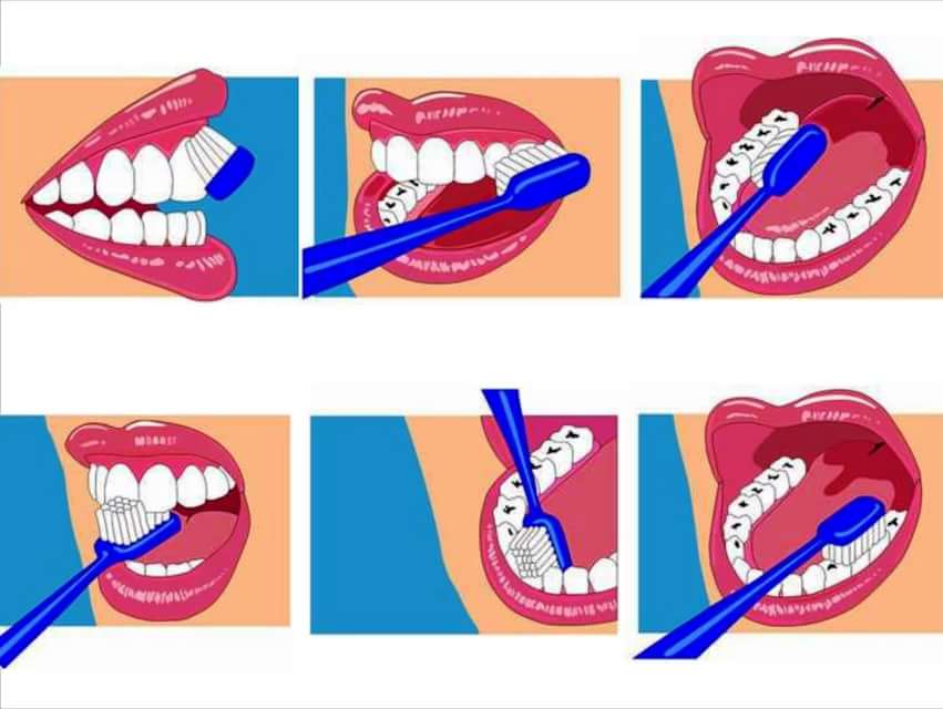 Зубная инфекция - симптомы, причины, лечение.