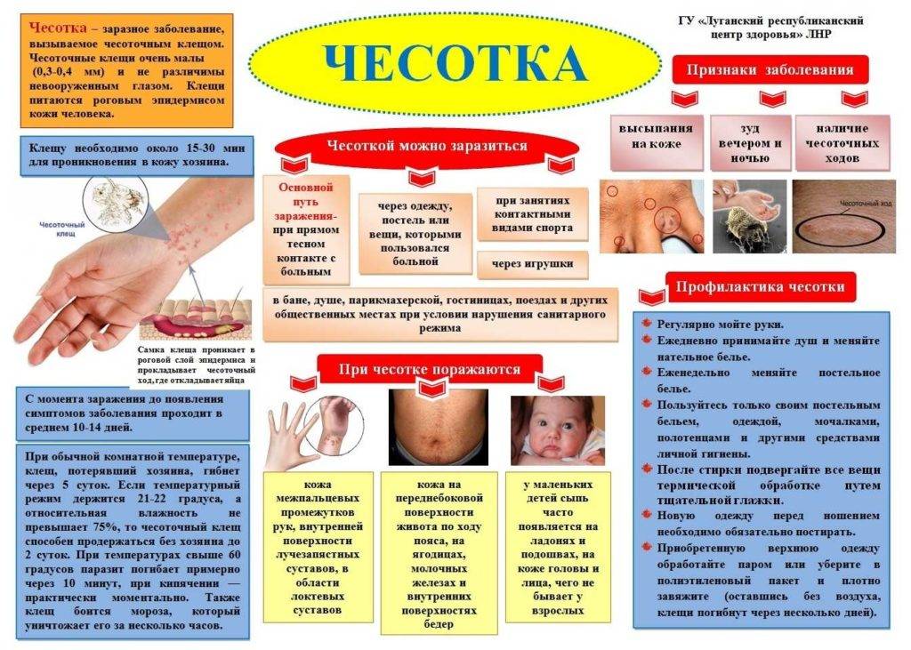 Конъюнктивит у детей: симптомы, лечение, профилактика - энциклопедия ochkov.net
