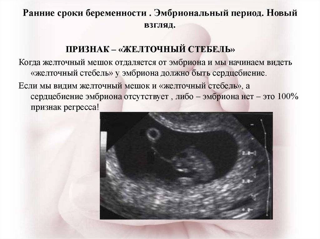 Признаки беременности после переноса эмбрионов