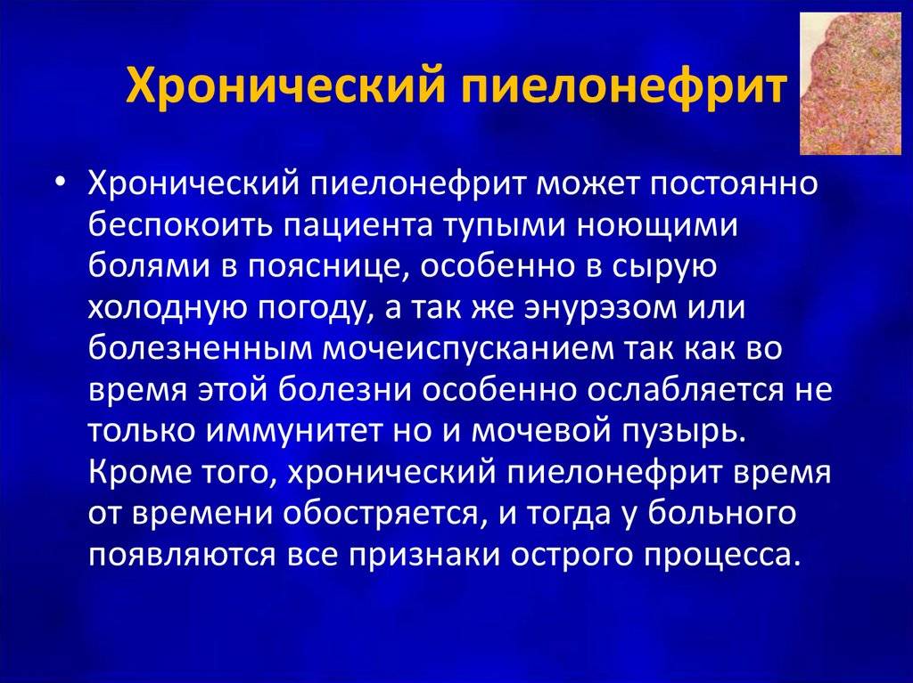 Хронический пиелонефрит