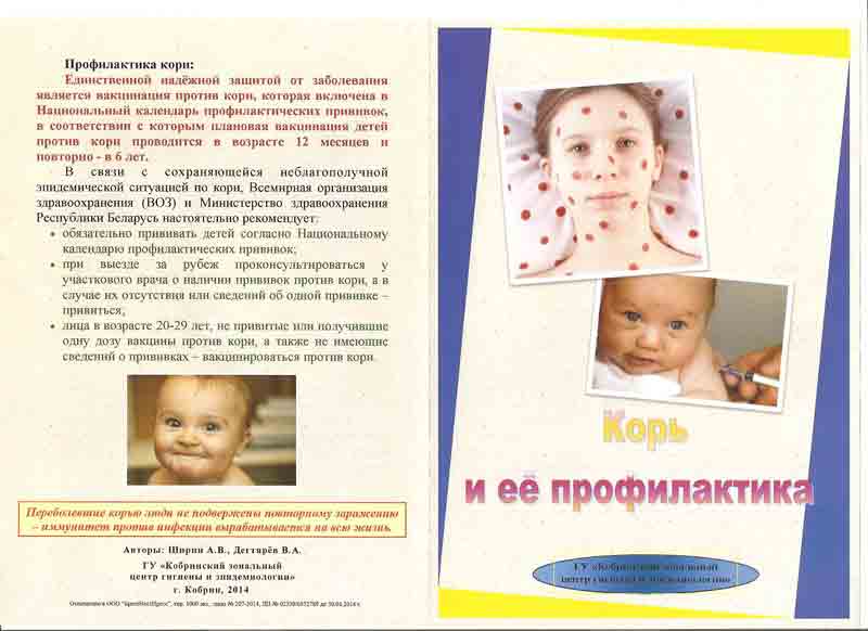 Вакцина m-m-p ii в москве - прививка против кори, краснухи и паротита - цена, описание вакцины