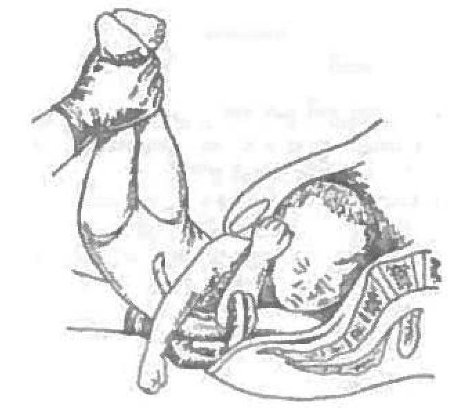 Расхождение костей таза при беременности | «юнона»