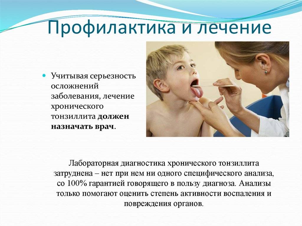 Лечение тонзиллита у ребенка