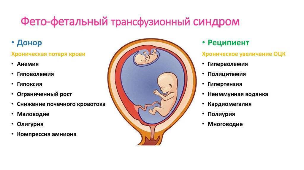 Многоплодная беременность, узи при многоплодной беременности