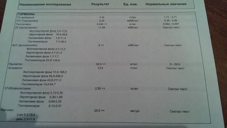 Диагностика плюс узнать результаты. Гормональные исследования крови прогестерон у женщин норма. Расшифровка анализа на прогестерон у женщин. Прогестерон анализ норма у женщин. Прогестерон норма у женщин по возрасту.