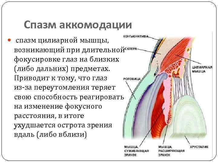 Аккомодационная и анатомическая близорукость: диагностика - энциклопедия ochkov.net