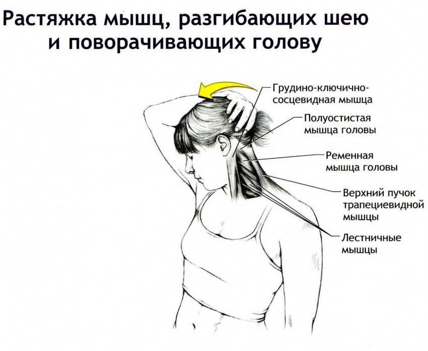 Боль в шее – причины, возможные заболевания| мотрин®