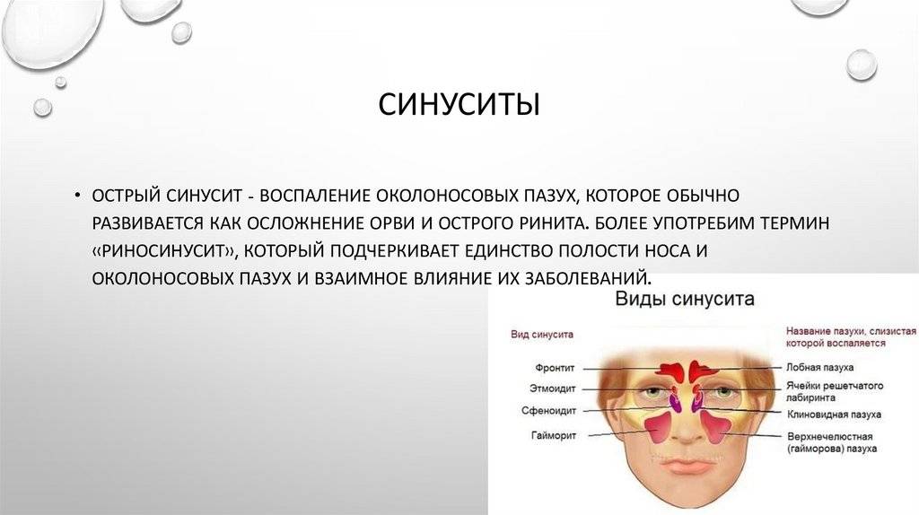 Лобный синусит (фронтит): что это и как лечить?