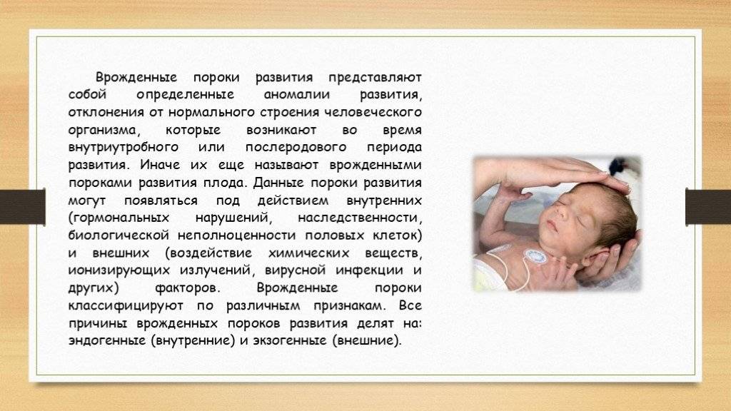 Пороки развития новорожденных: классификация, причины возникновения | клиника "центр эко" в москве